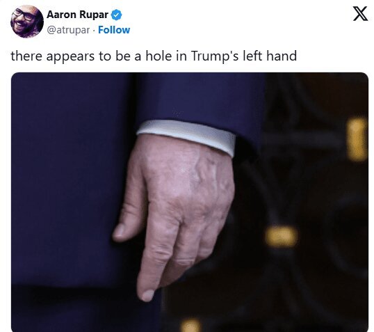 تصاویر دست ترامپ جنجالساز شد/ حدسوگمانها درباره سلامتی او تصاویر دست ترامپ جنجالساز شد/ حدسوگمانها درباره سلامتی او