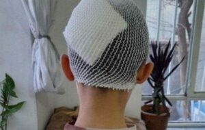 کلاس درس یا میدان خشم؟/ پرتاب لیوان سر دانشآموز گلستانی را شکافت کلاس درس یا میدان خشم؟/ پرتاب لیوان سر دانشآموز گلستانی را شکافت