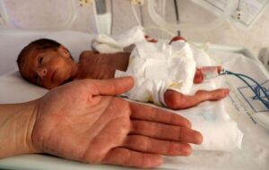 ترخیص نوزاد ۷۰۰ گرمی پس از ۴۸ روز تلاش شبانهروزی کادر درمان ترخیص نوزاد ۷۰۰ گرمی پس از ۴۸ روز تلاش شبانهروزی کادر درمان