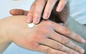 راهکارهای طب ایرانی برای حفظ سلامت پوست و بدن در فصل سرد راهکارهای طب ایرانی برای حفظ سلامت پوست و بدن در فصل سرد