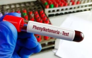 خبر خوش برای بیماران PKU؛ توزیع نان فاقد پروتئین خبر خوش برای بیماران PKU؛ توزیع نان فاقد پروتئین