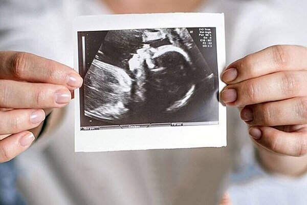 همهچیز درباره IVF؛ شانس موفقیت، هزینهها و واقعیتها همهچیز درباره IVF؛ شانس موفقیت، هزینهها و واقعیتها