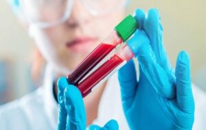 چقدر احتمال دارد مبتلا به سرطان شویم چقدر احتمال دارد مبتلا به سرطان شویم